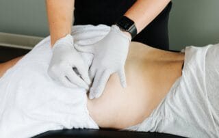 physical therapist performing dry needling